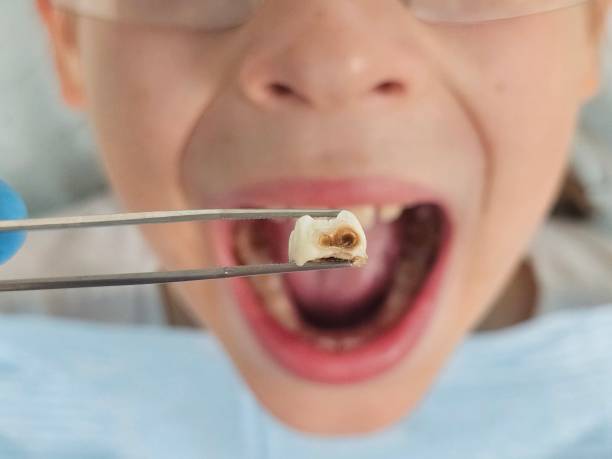 Best Emergency Gum Treatment in Manning, IA