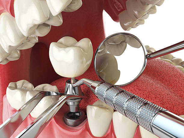 Best Pediatric Emergency Dentist in Manning, IA